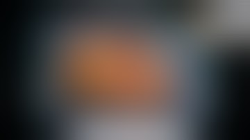 Robotic Ureteral Reimplantation (re-implante ureteral em conduto ileal)