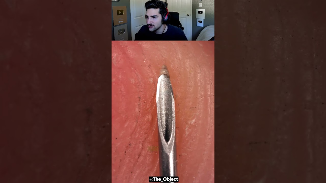 Needle in Slow Motion! 🤯 @The_Object