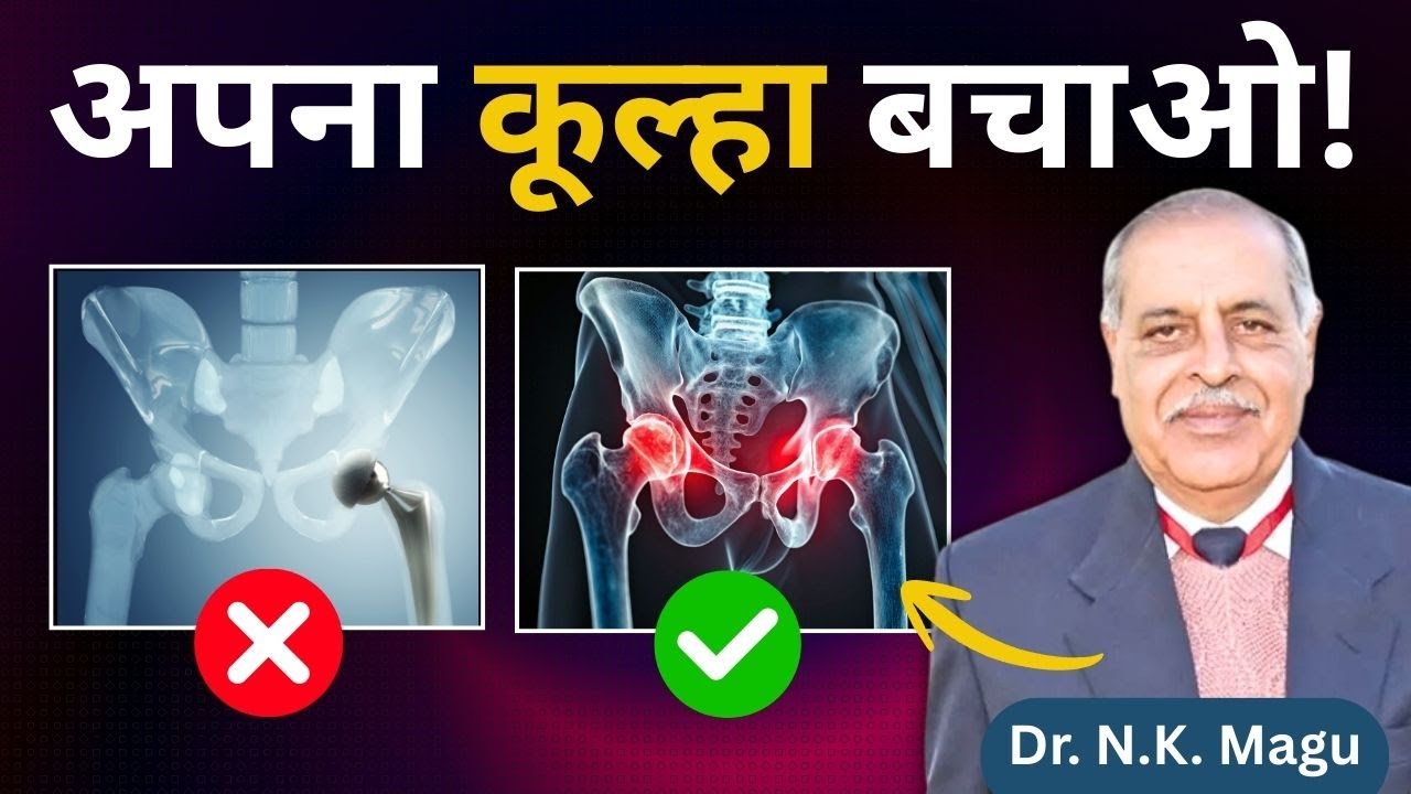 AVN Hip Treatment without Surgery | क्या हर AVN में Hip Replacement ज़रूरी है?