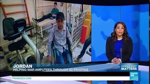 3D Printing Prosthetic Limbs in Jordan - FRANCE 24