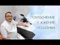 ↪ Покраснение и жжение мошонки. Клинический случай №77