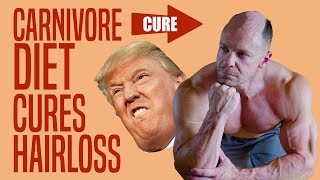 Carnivore Diet CURES Hair Loss and Male Pattern Baldness?