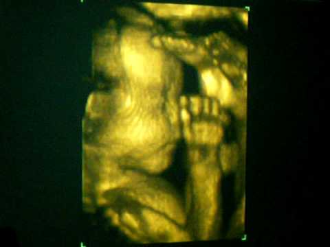 4D ultrasound of 24 week baby