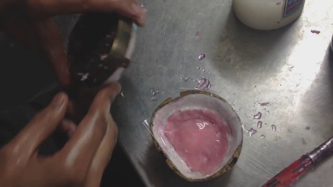 Packing of denture YouTube