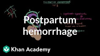 Postpartum hemorrhage | Reproductive system physiology | NCLEX-RN | Khan Academy