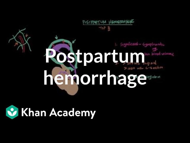 Postpartum hemorrhage | Reproductive system physiology | NCLEX-RN | Khan Academy