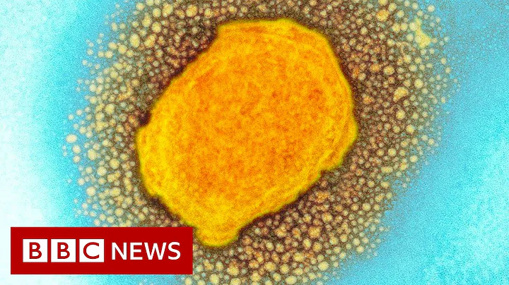 How to spot symptoms of monkeypox - BBC News - DayDayNews