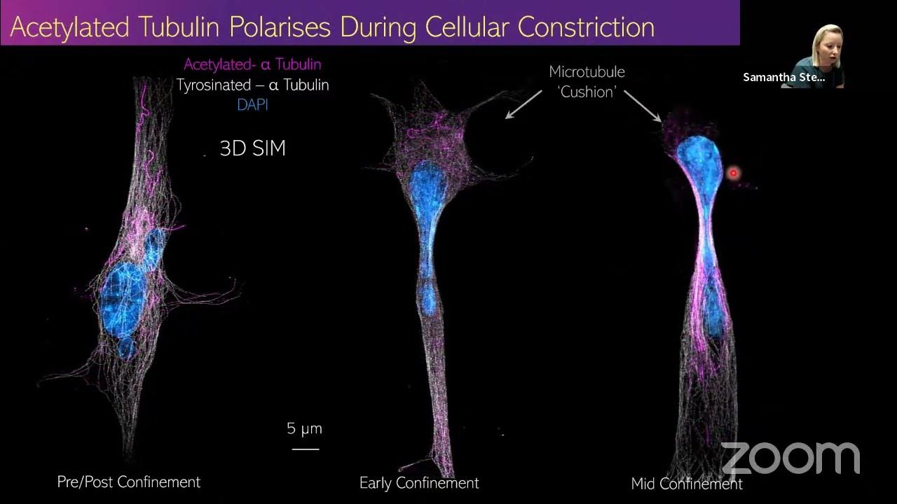Cell Migration Seminars 59 Samantha Stehbens & Audrey Williams YouTube