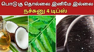 பொடுகு தொல்லை இனி இல்லை | how to remove dandruff | Tamil hairstyle dandruff