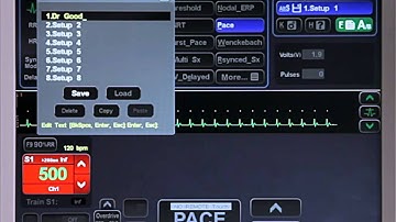 6B - General - Setups Naming