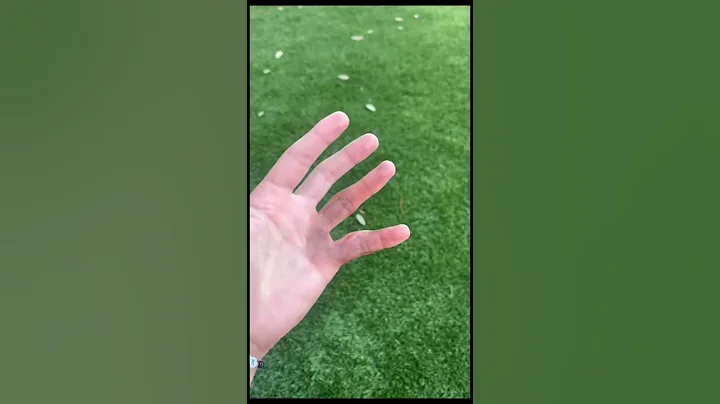 Update on my broken pinky…