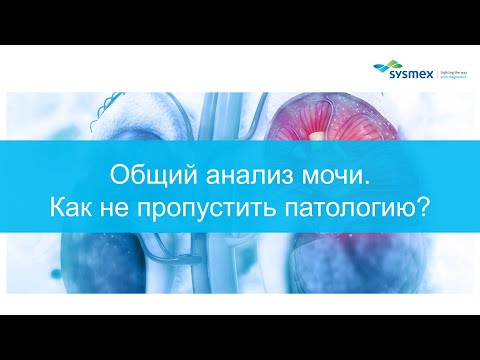 Общий анализ мочи - как не пропустить патологию?