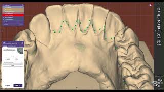 #exocad splint