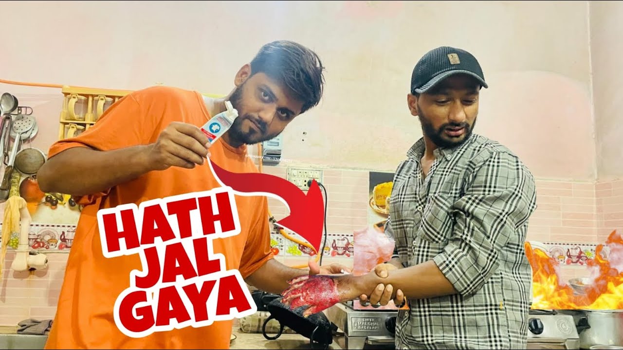 Pakoray Banaty Huay Hath Jal Gaya 😰 | Challenge Goes Wrong