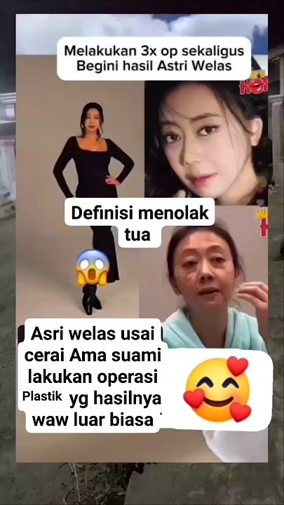 Asri welas oplas 3 kali hasilnya waw luar biasa #asriwelas #shorts #viralshorts