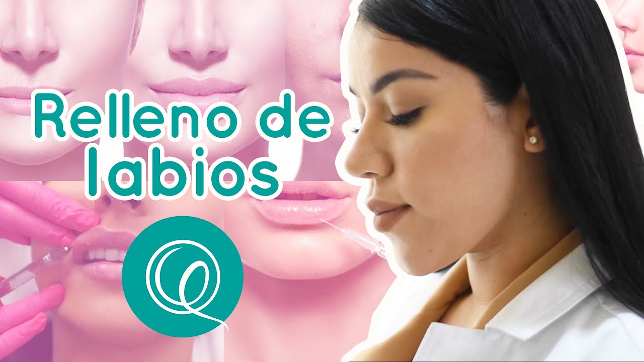 Relleno de labios con ÁCIDO HIALURÓNICO- Dra. Génesis Quintero