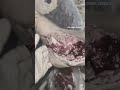 qanqrena müalice yara baxim merkezi bakida icbari tibbi sigorta trofiki xora diaqnoz mualice hekimi