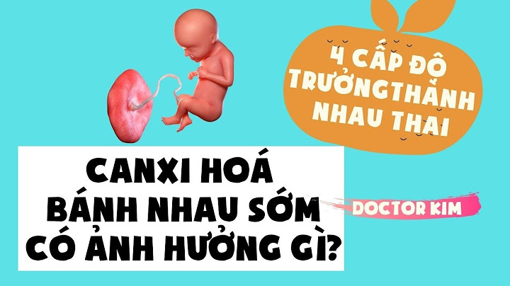 Nhau bám mặt sau nhóm 2 độ 1 là gì