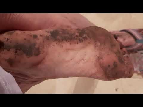 My Feet and Foot Fetish #114 Dirty Feet Dirty FlipFlops❣🥰❣