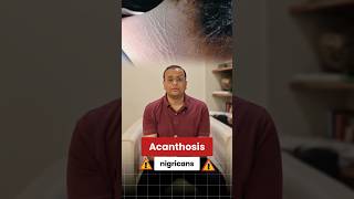 Dark Neck? It Could Be Acanthosis Nigricans & Insulin Resistance #thyroidpatient #doctor