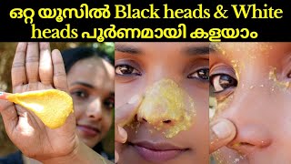 How to Remove blackheads & whiteheads from nose & face naturally at home❤Instant & permanent result screenshot 5