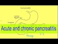 Acute and chronic pancreatitis | Gastrointestinal pathology | Medicine