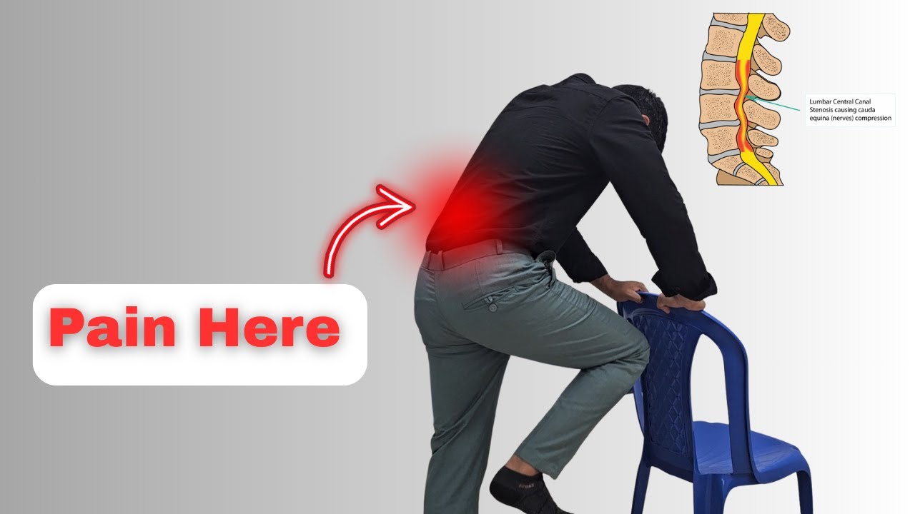 Lumbar Canal Stenosis (Understand Ist) Physiotherapy Treatment 