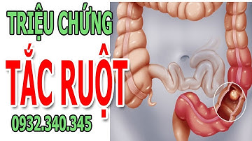 Triệu chứng tắc ruột - Cách nhận biết tắc ruột non, tắc ruột già