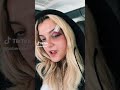 Bebe Rexha Shows Her Injury After The Hit Of A Phone During Her Show 