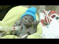 Baby Gorilla Born By Rare C-Section at San Diego Zoo Safari Park