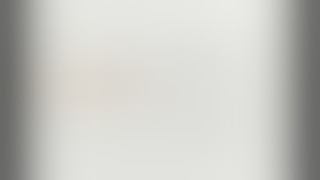 Laparoscopic proximal gastrectomy with jejunal interposition and double tract reconstruction - J Rao