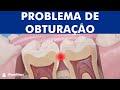 Restauração dental – Problema de obturação ©