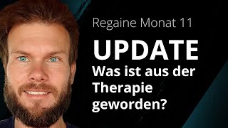 Regaine Monat 11 | Was ist aus der Regaine Therapie geworden?