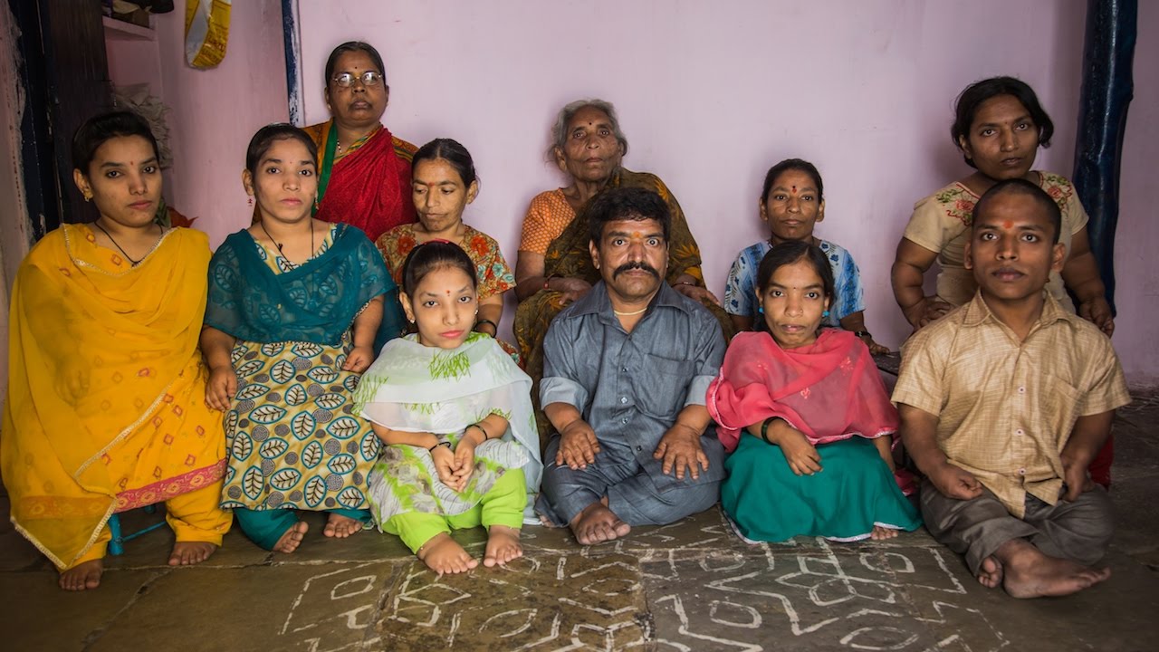 India’s Incredible Dwarf Family BORN DIFFERENT