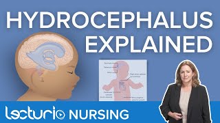 Hydrocephalus : Definition, Symptoms, and Nursing Interventions | Lecturio Nursing Pediatrics