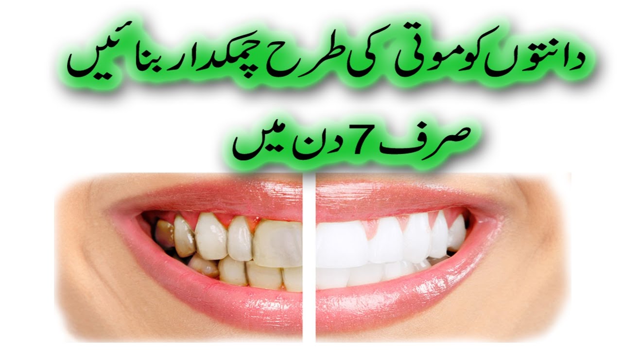 How To Whiten Teeth Very Fast Teetch Whitening At Home