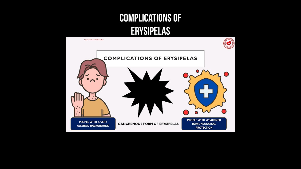 Complications of erysipelas 