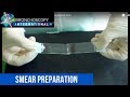 Smear Preparation after Bronchoscopic Needle Aspiration