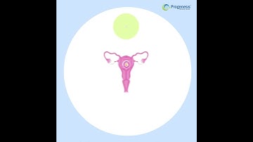 IVF Process Step-by-step animation.