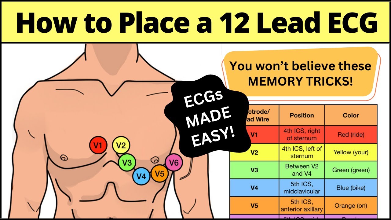 12 Lead ECG Placement MADE EASY [EMT, Nursing, Paramedic] #ecg #nursing ...