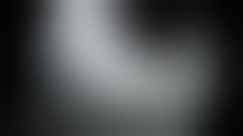 Edinburgh VATS Lobectomy for Pulmonary Sequestration