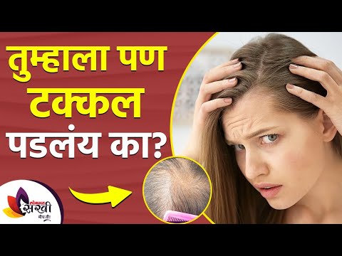 टक्कल पडलेल्या जागेवर काय करावं | How to Get Rid of Bald Spots | Baldness Cure | Baldness Treatment