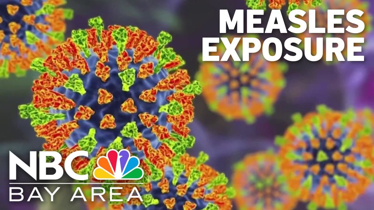 Two Bay Area health agencies warn of potential measles exposure - YouTube
