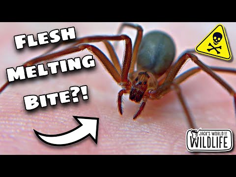 BROWN RECLUSE BITE! How DEADLY Is It REALLY?