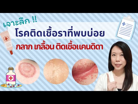 วีดีโอ: Candidemia วินิจฉัยได้อย่างไร?