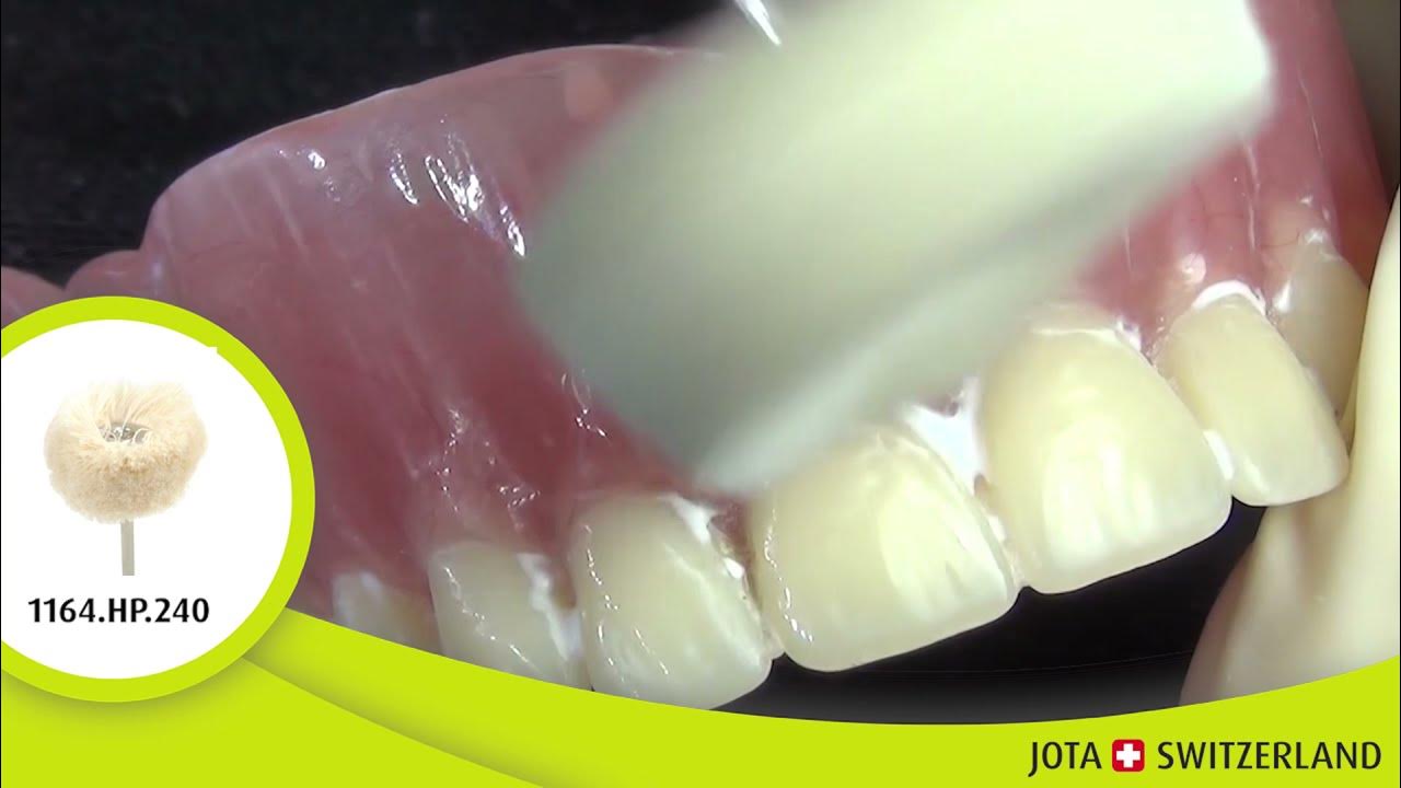 Jota Denture Polishing Kit 1877 YouTube