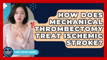 How Does Mechanical Thrombectomy Treat Ischemic Stroke? - Stroke Support Channel