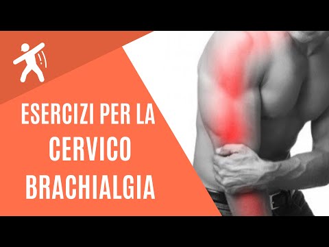 Esercizi Cervicobrachialgia | Il dolore lungo il braccio