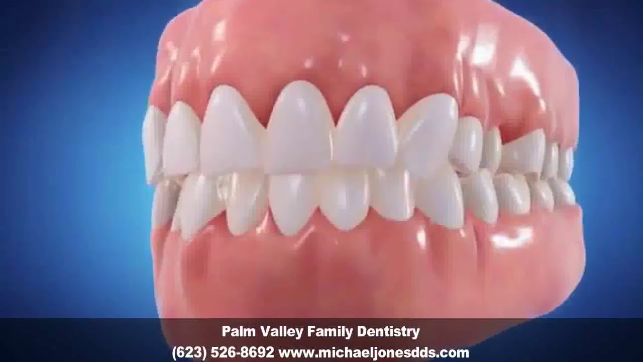 Invisalign Dentist Avondale AZ