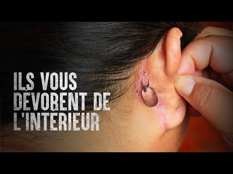 Vidéo: Les parasites canins se nourrissent-ils de sang?